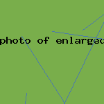 photo of enlarged clitoris
