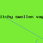 itchy swollen vagina